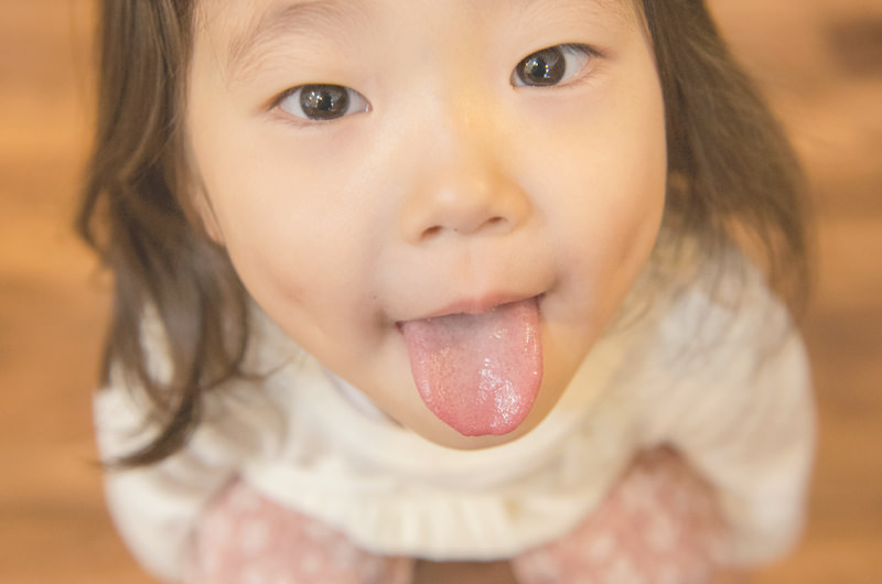 MFT(口腔筋機能療法)