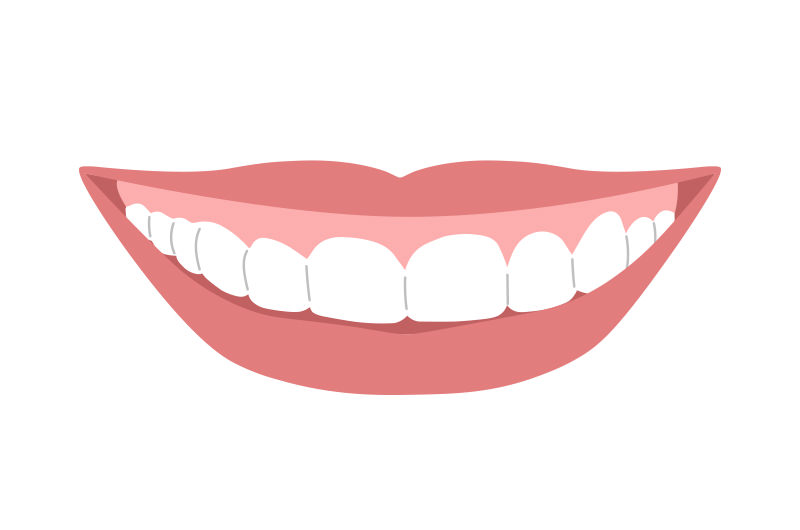 ガミースマイル